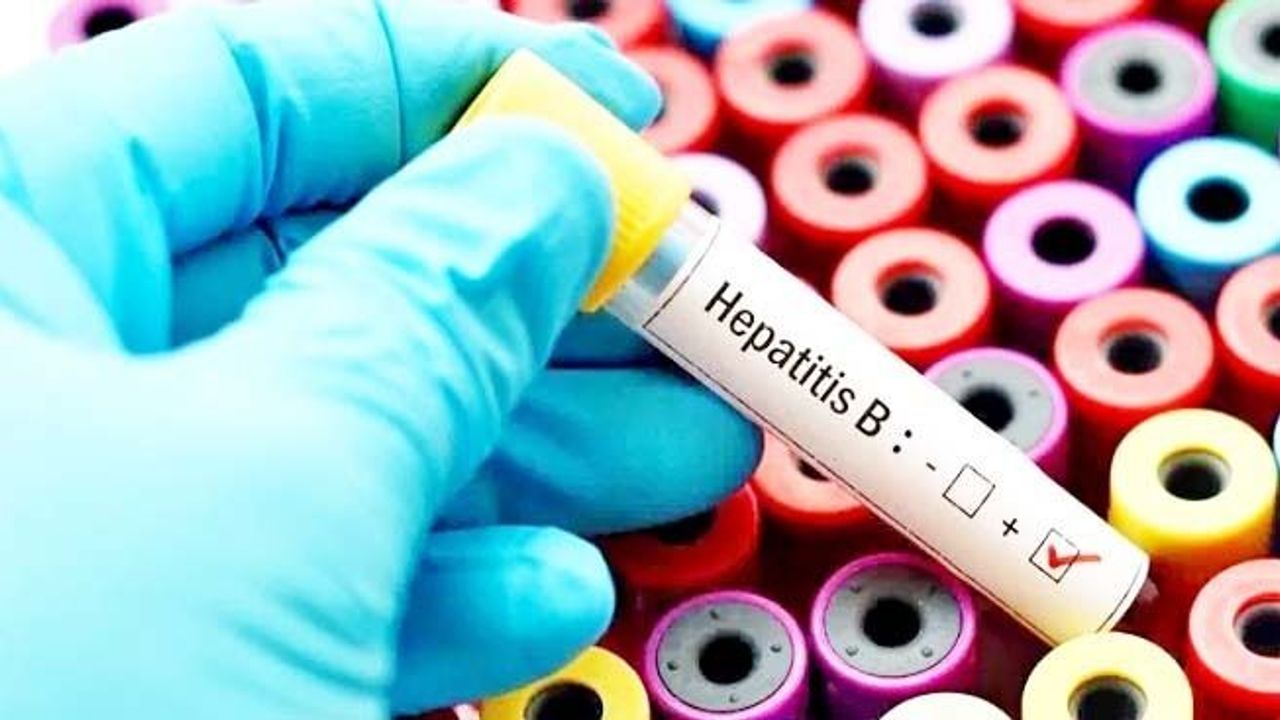 Hepatit B